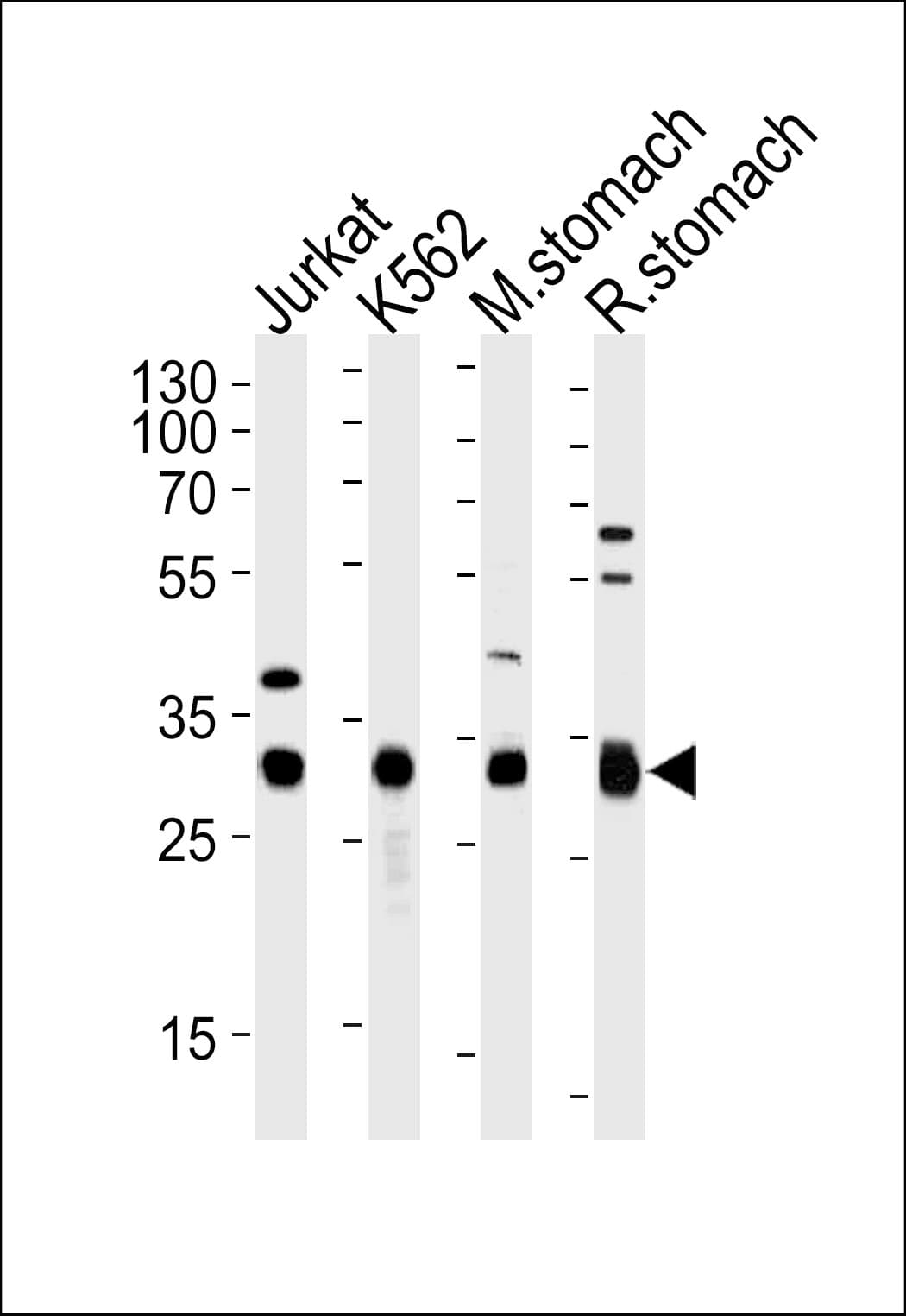 Polyclonal Rabbit anti-Human Esterase D / ESD Antibody (aa68-102, WB)