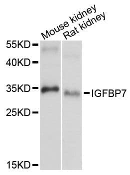 IGFBP7 / TAF Antibody