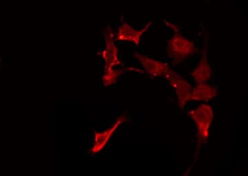 Polyclonal Rabbit anti-Human FZD1 / Frizzled 1 Antibody (IF, WB)