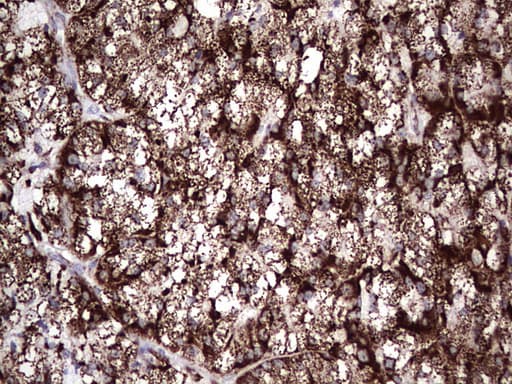 PIK3CD / PI3K Delta Antibody (aa286-610, clone OTI1D11)