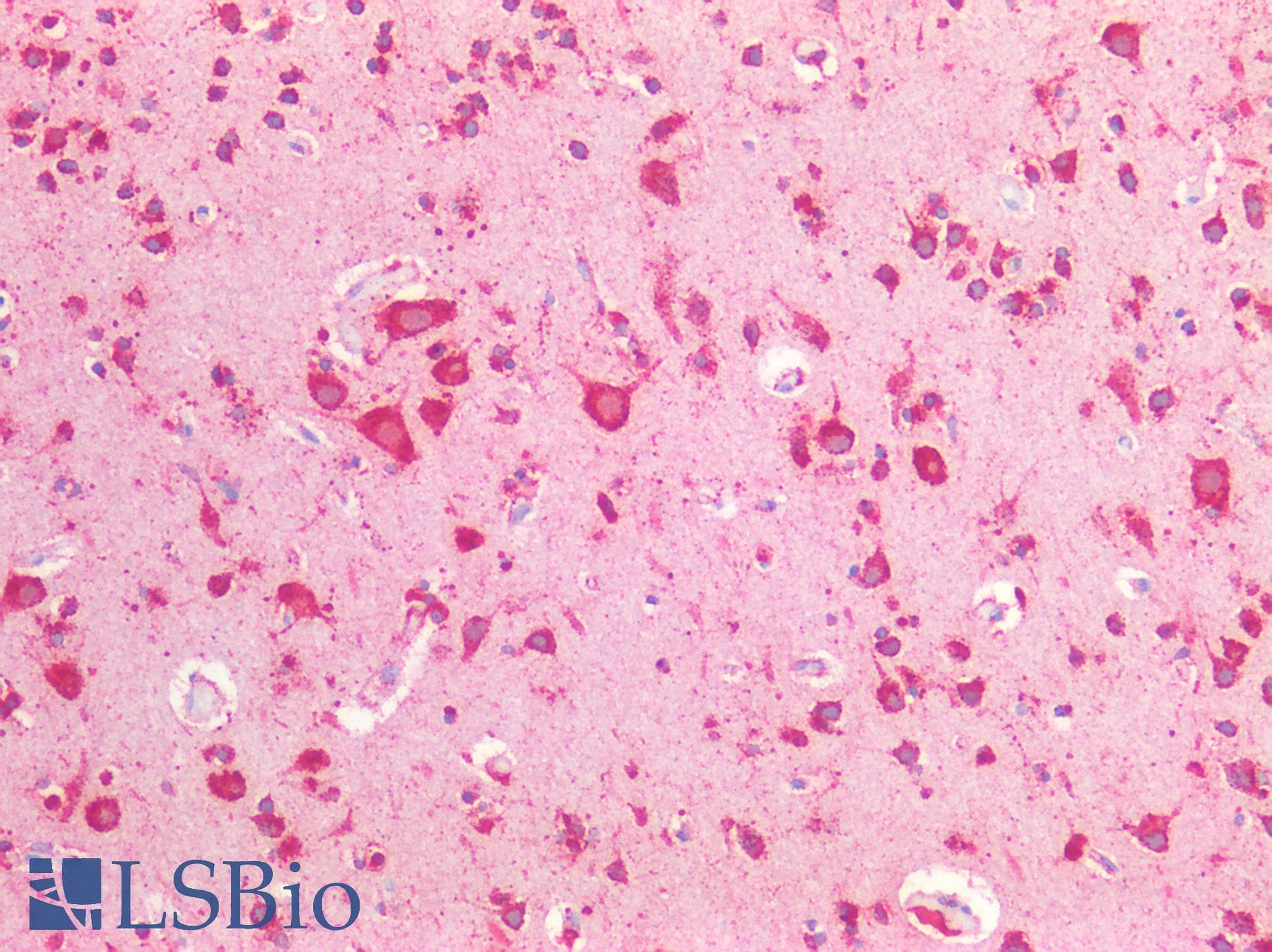 PathPlus™ Polyclonal Rabbit anti-Human CTSD / Cathepsin D Antibody (aa72-292, IHC, WB)