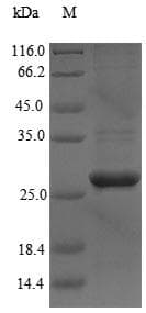Paenibacillus macerans Cyclomaltodextrin glucanotransferase Protein (Recombinant 6His-SUMO, N-terminus)