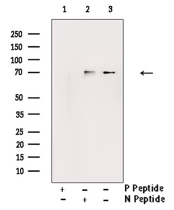 EZR / Ezrin Antibody (phospho-Tyr478)