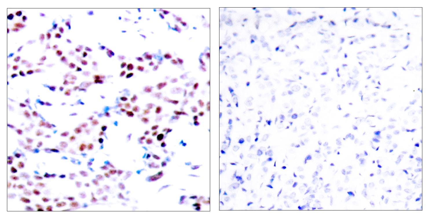 JUN / c-Jun Antibody (phospho-Thr91)