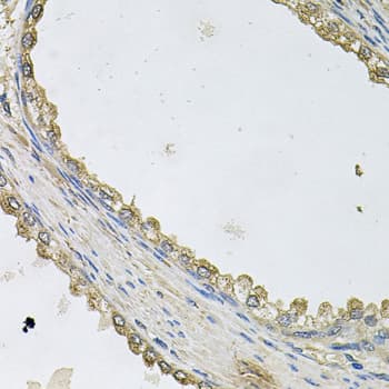MTERF3 / MTERFD1 Antibody