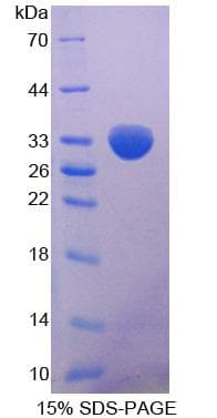 Mouse MTAP Protein (Recombinant His-S)