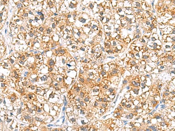 Polyclonal Rabbit anti-Human HRSP12 / UK114 Antibody (IHC, WB)