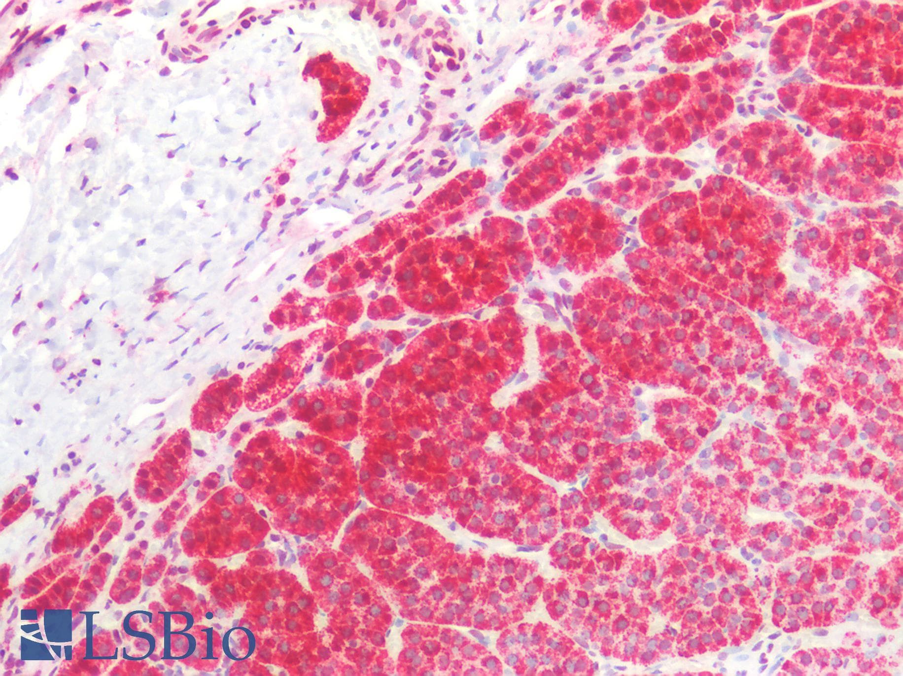 DRAK1 / STK17A Antibody