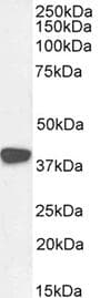 C5AR2 / GPR77 / C5L2 Antibody