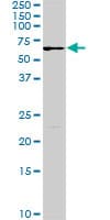 IHC-plus™ FGR Antibody (clone 3G10)