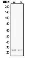 PPP1R14D / CPI17-Like Antibody (Internal)