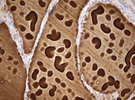 TG / Thyroglobulin Antibody (aa2511-2768, clone OTI3E12)