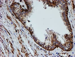 PSMB9 Antibody (clone OTI1G7)