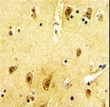 Polyclonal Rabbit anti-Human ADRB2 Antibody (Ser364, IHC, WB)