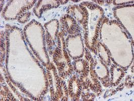 Monoclonal Mouse anti-Human ERBB2 / HER2 Antibody (clone OTI12G4, Carrier-free, aa676-1255, IHC, IF, WB)