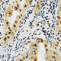 Polyclonal Rabbit anti-Human PRPF39 Antibody (Internal, IHC, WB)