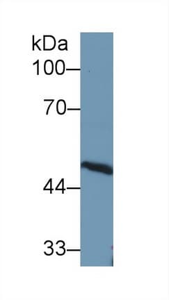 Antithrombin Antibody (aa150-426, APC)