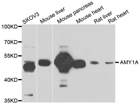 Polyclonal Rabbit anti-Human AMY1A / Salivary Amylase Antibody (IHC, WB)