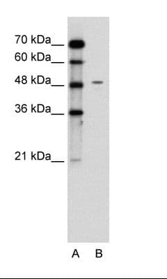 Polyclonal Rabbit anti-Human CHGA / Chromogranin A Antibody (C-Terminus, IHC, WB)