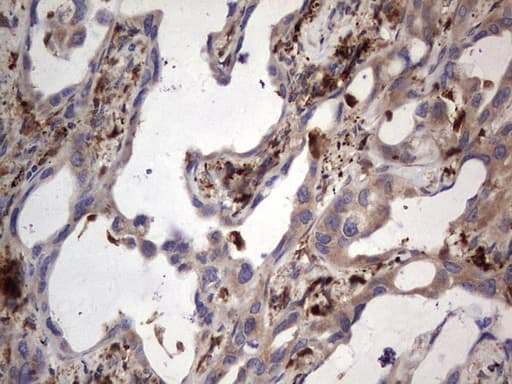 Monoclonal Mouse anti-Human MTDH / Metadherin Antibody (clone OTI2H4, aa70-582, IHC, WB)