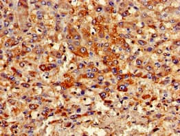 PIPOX / Sarcosine Oxidase Antibody