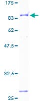 Human BTD / Biotinidase Protein (Recombinant GST)