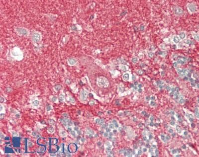 PathPlus™ CD81 Antibody (90-210 aa, Internal)