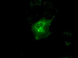 PRKAR1A Antibody (clone OTI6C7)