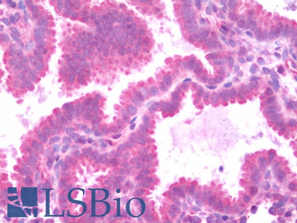 IHC-plus™ VAV1 / VAV Antibody (aa83-568)