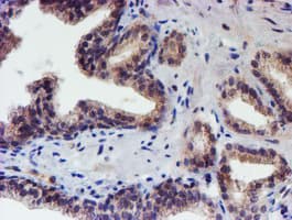 RPS6KB1 / P70S6K / S6K Antibody (clone OTI1G4, Carrier-free)