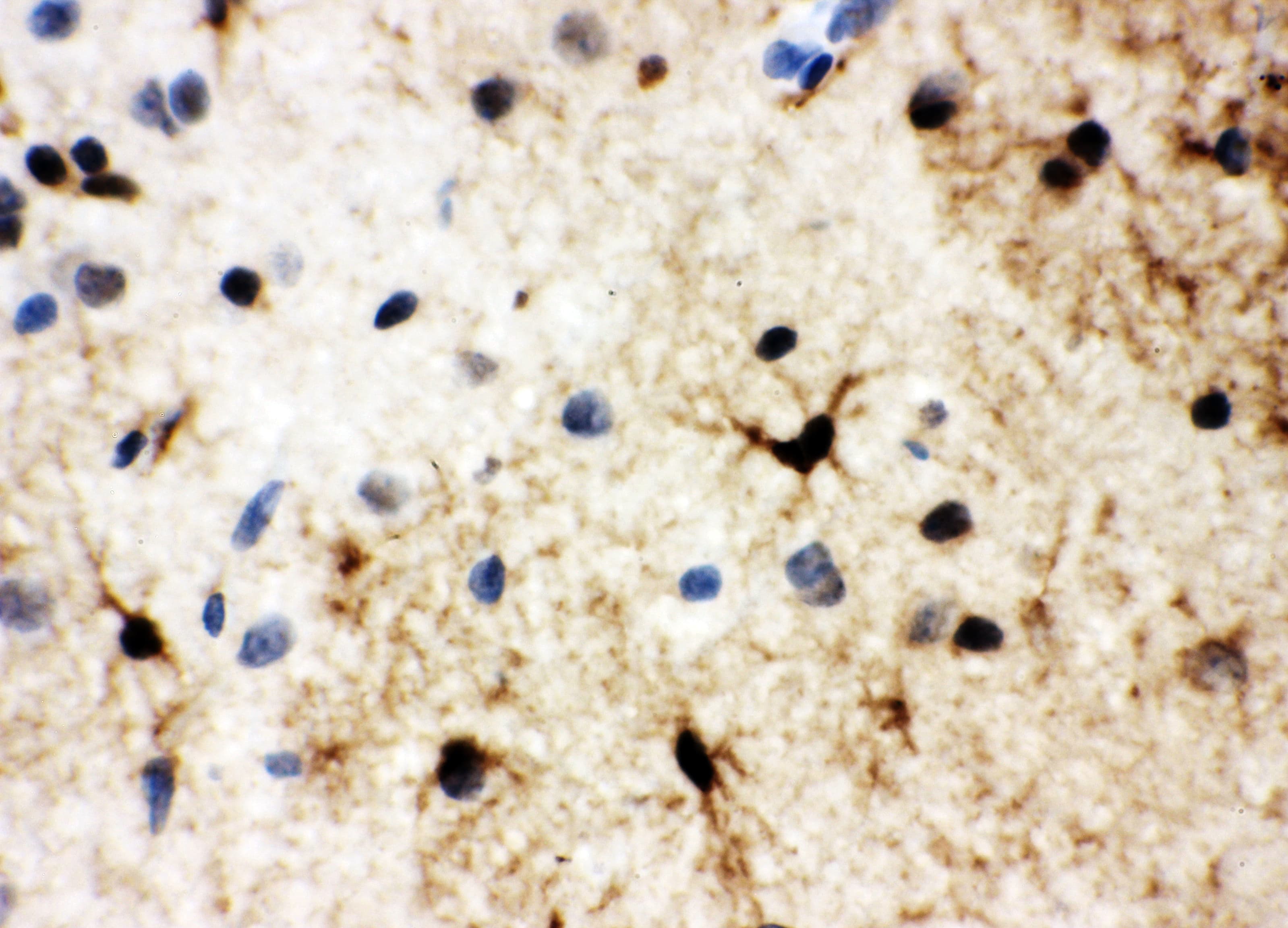 HSF2 Antibody (aa82-102)