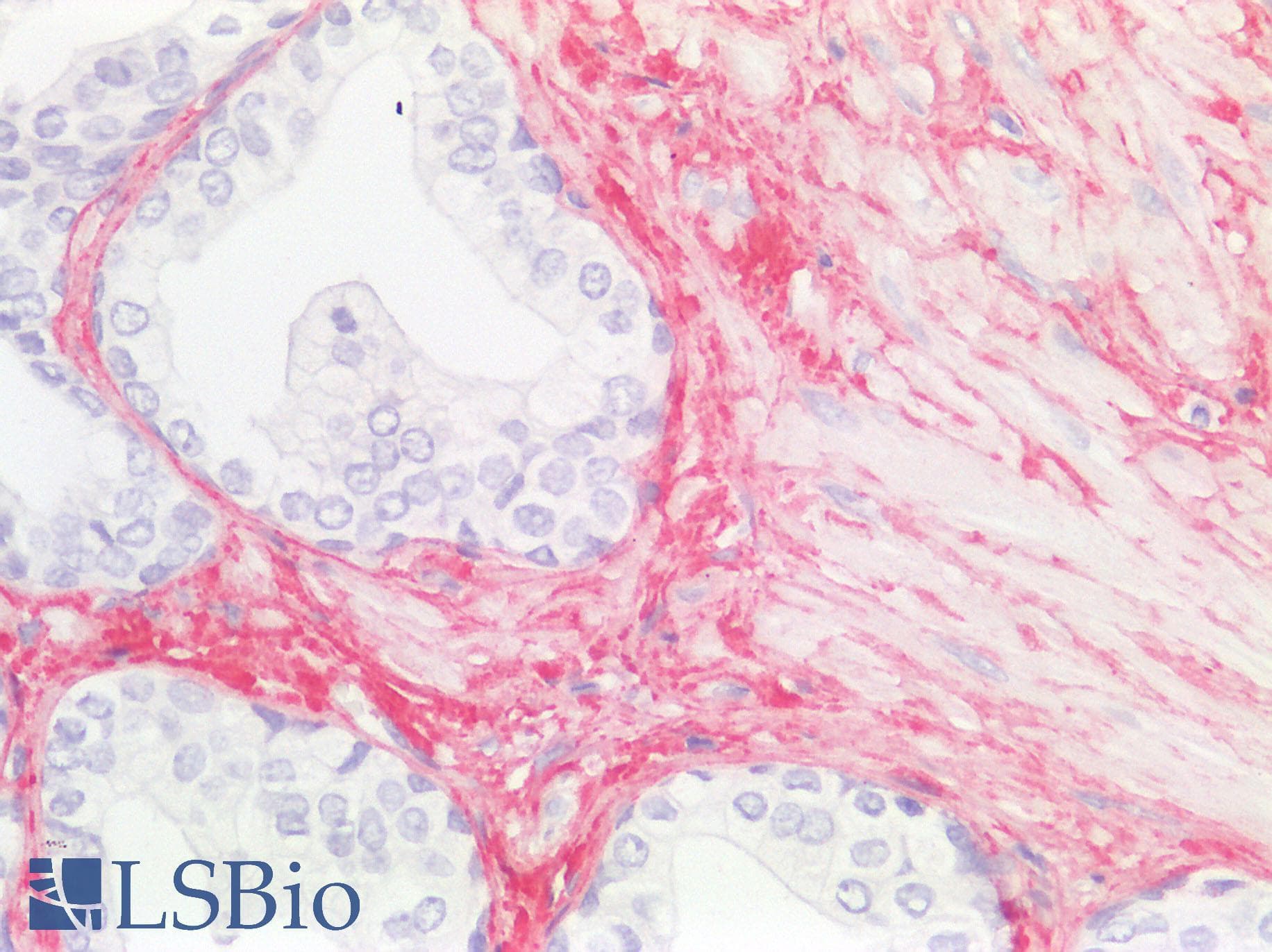 IHC-plus™ GDF15 Antibody (C-Terminus, clone 6D12.H10.E4)