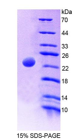 Rat MATK Protein (Recombinant His-T7)