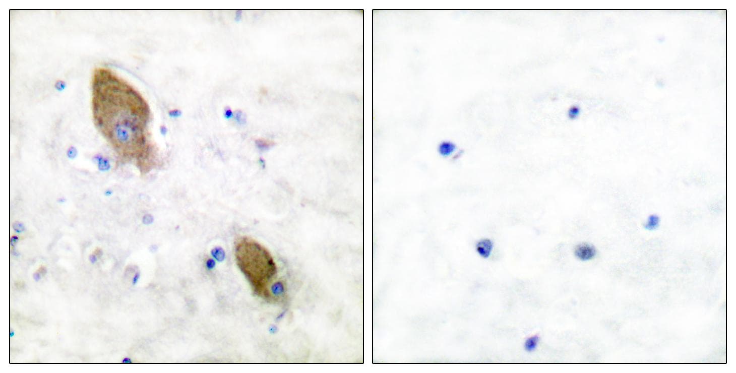PTK2B / PYK2 Antibody (phospho-Tyr881)