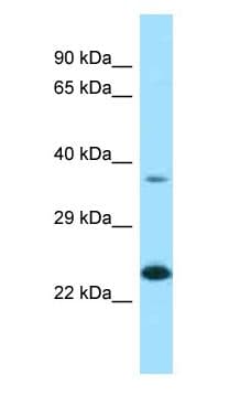 Polyclonal Rabbit anti-Human EPDR / EPDR1 Antibody (aa47-96, WB)