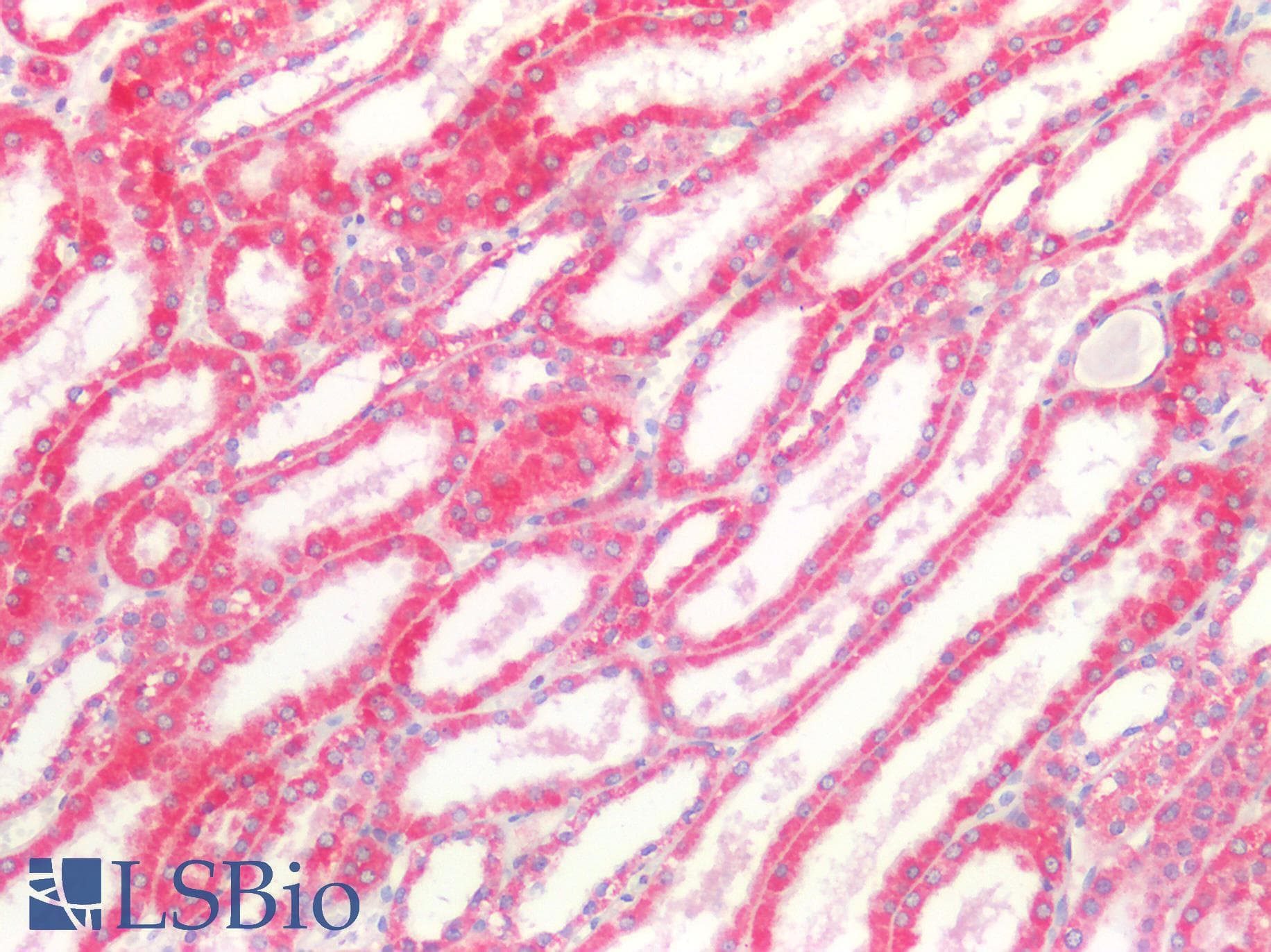 PathPlus™ ROS1 / ROS Antibody (aa1744-1777)