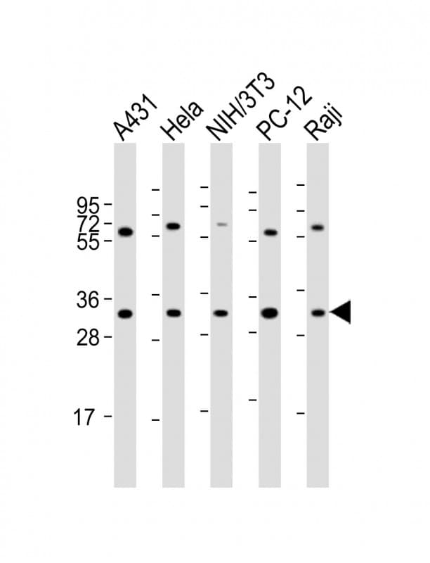 Polyclonal Rabbit anti-Human RPL7A / Ribosomal Protein L7a Antibody (aa200-235, WB)