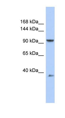 Polyclonal Rabbit anti-Human AP2B1 Antibody (C-Terminus, WB)