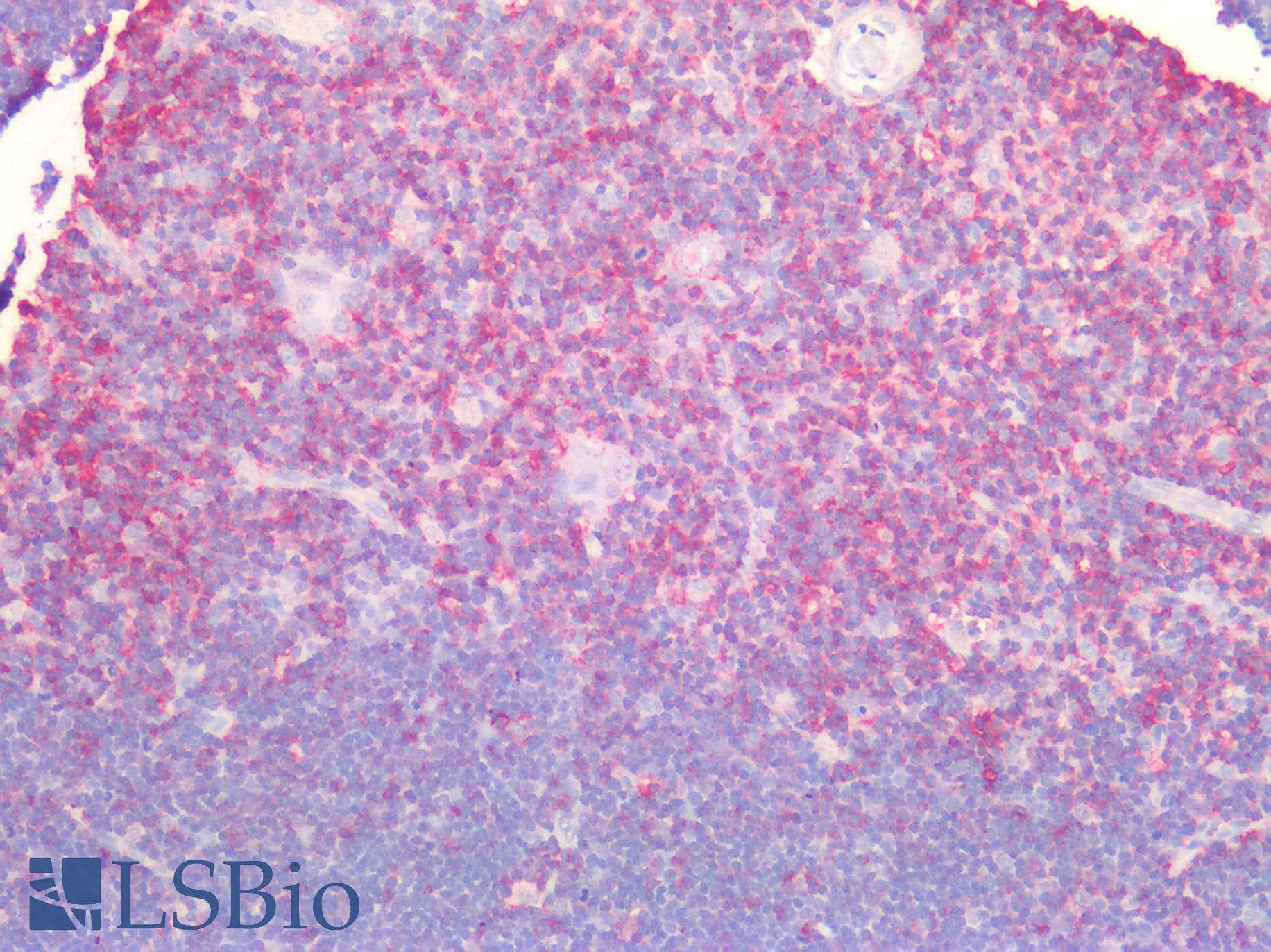 PathPlus™ CD44 Antibody (aa149-163)