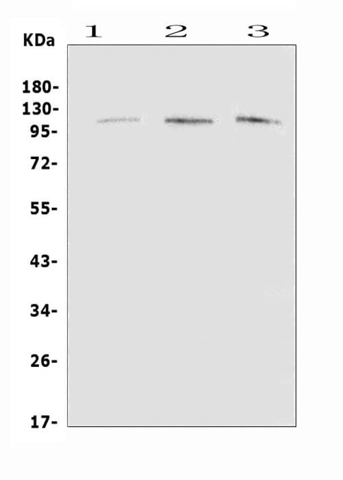 Polyclonal Rabbit anti-Human EML4 Antibody (IHC, WB)