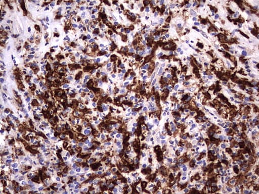 LGALS3 / Galectin 3 Antibody (clone OTI1C7)