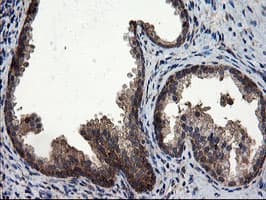CNOT4 / CLONE243 Antibody (clone OTI1H2)