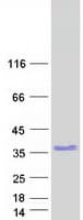 Human ZNF146 Protein (Recombinant Myc-DDK (Flag))