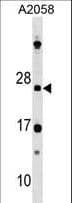 DRAP1 Antibody (aa1-29)