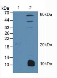 PPARG / PPAR Gamma Antibody (aa349-488)