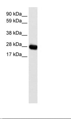 CAV3 / Caveolin 3 Antibody (N-Terminus)