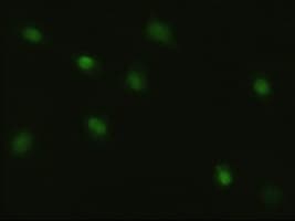 MYC / c-Myc Antibody (clone OTI3F2)