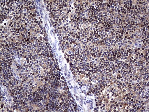 Monoclonal Mouse anti-Human MDM2 Antibody (clone OTI7F7, aa119-438, IHC, WB)