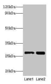 IHC-plus™ LGALS3 / Galectin 3 Antibody (aa2-250)