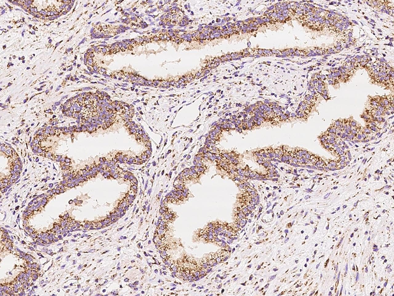 Polyclonal Rabbit anti-Human LIMPII / SCARB2 Antibody (IHC, WB)